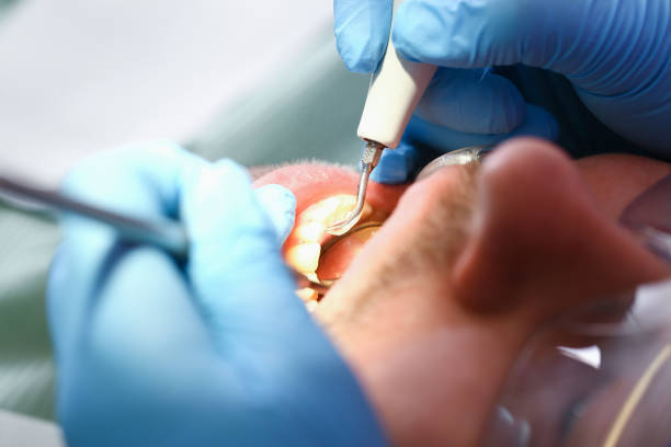Best Emergency Cosmetic Dentistry in Vaville, CA